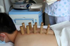 运城中医药消夏养生节暨“冬病夏治”活